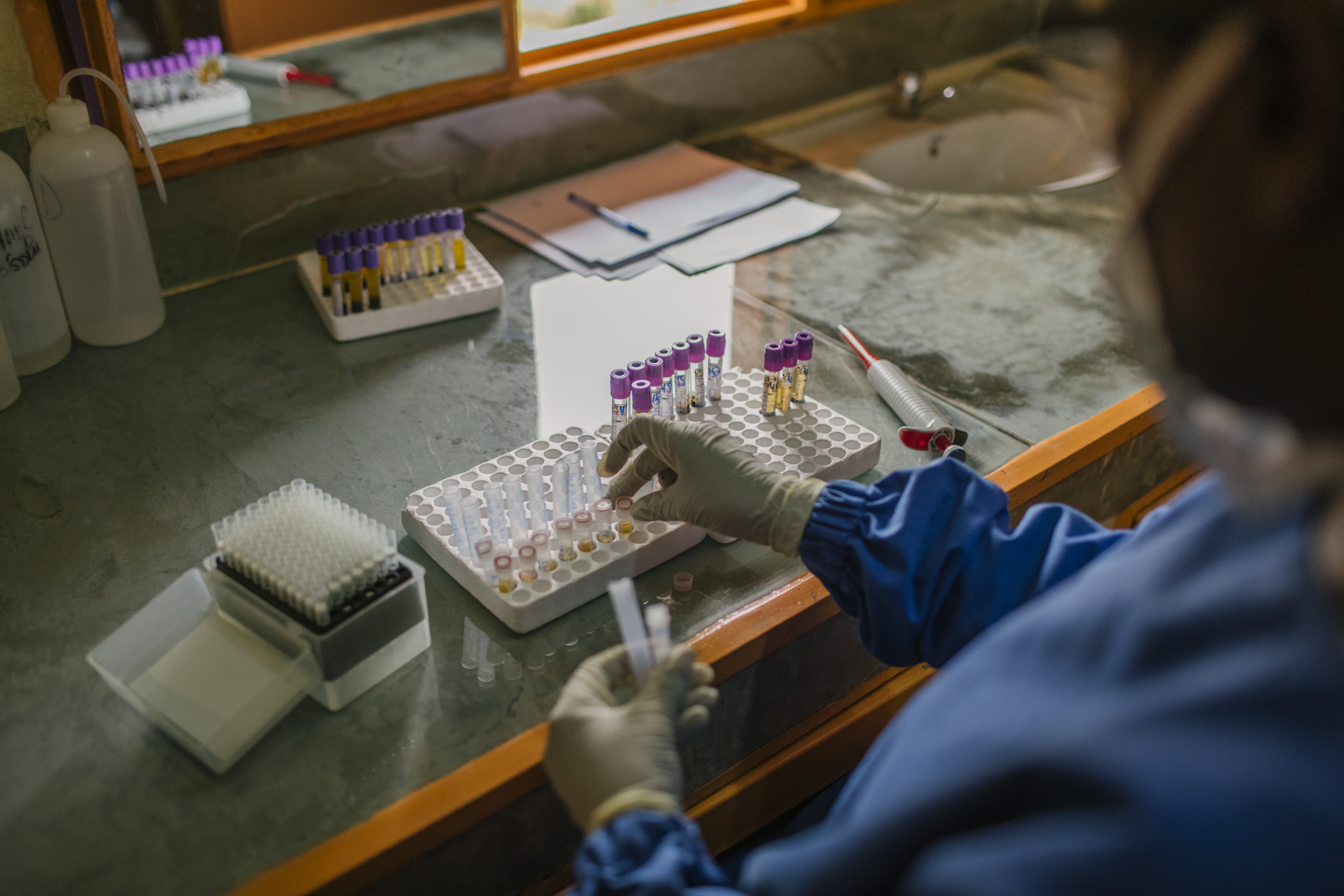 Burundi female lab tech Anita Shimirimana tests samples