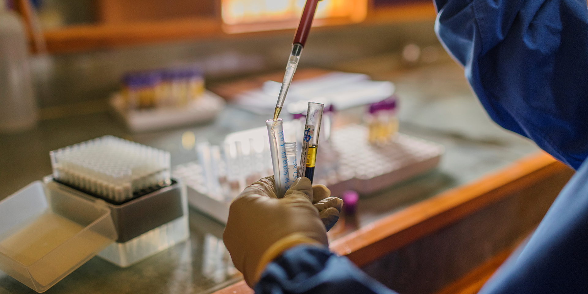 Lab technician with blood samples